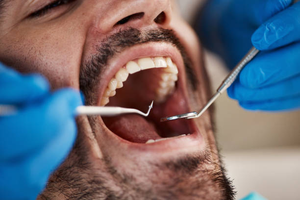 Best Cracked Tooth Emergency Dentist  in Dunean, SC
